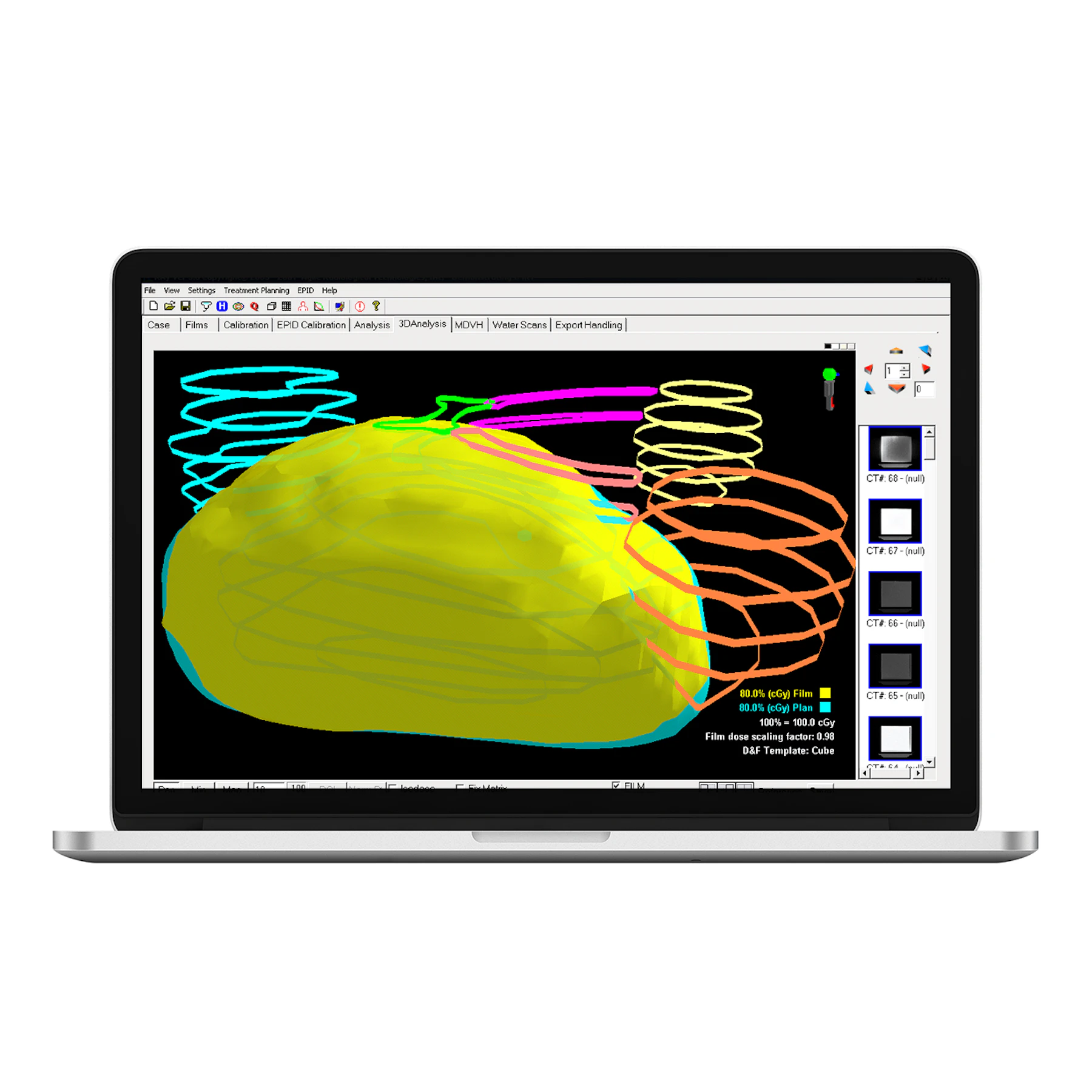 RAy™ 3D Dosimetry Software, includes web training,…